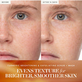 Before and after results from KORA Organics Turmeric Brightening and Exfoliating Scrub + Mask
