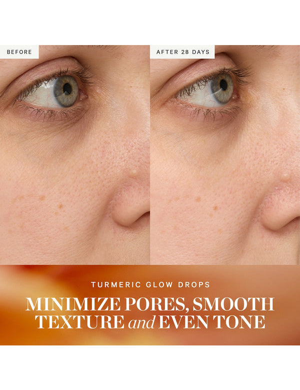 Before and after results from KORA Organics Turmeric Glow Drops Niacinamide Serum
