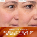 Before and after results from KORA Organics Turmeric Glow Moisturiser