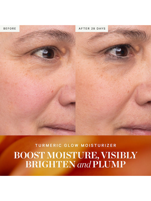 Before and after results from KORA Organics Turmeric Glow Moisturiser