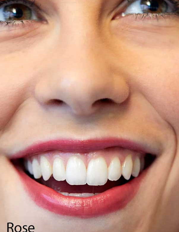 A close-up of a smiling person’s face showcases their white teeth and natural pink lips enhanced by Luk Beautifood Lip Nourish Lipsticks 3g, with the lower part of the word "Rose" visible in the bottom left corner.