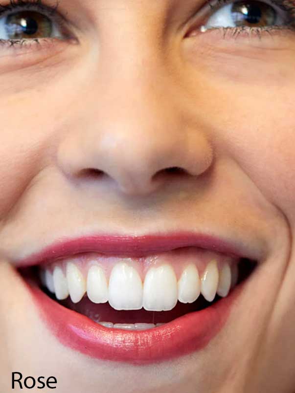 A close-up of a smiling person’s face showcases their white teeth and natural pink lips enhanced by Luk Beautifood Lip Nourish Lipsticks 3g, with the lower part of the word "Rose" visible in the bottom left corner.