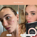 Before and after skin comparison using Tropeaka Skin Collagen