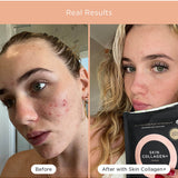 Before and after skin comparison using Tropeaka Skin Collagen