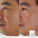 Before and after comparison using The Beauty Chef Glow Ageless