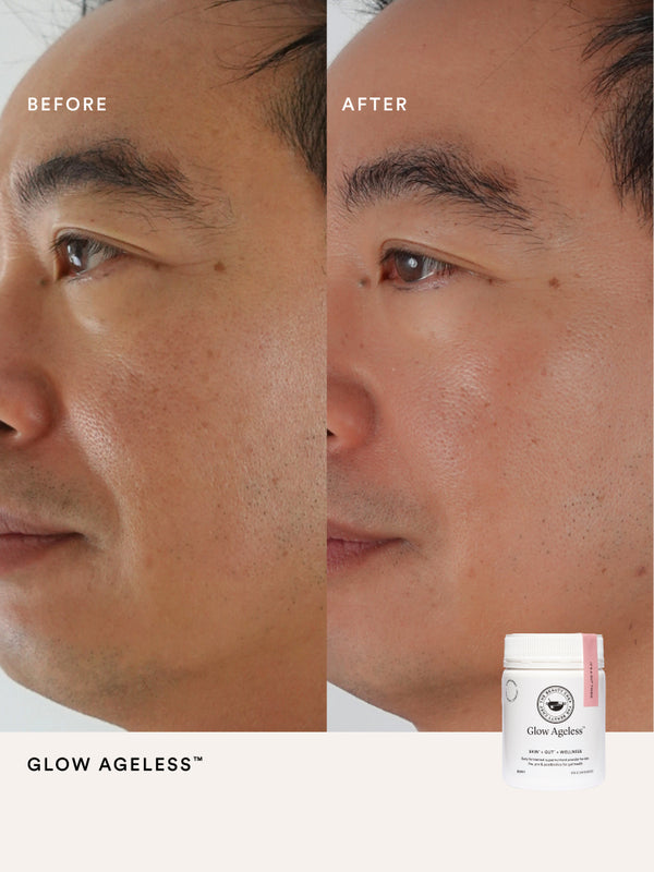 Before and after comparison using The Beauty Chef Glow Ageless
