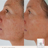 Second before and after comparison using The Beauty Chef Glow Ageless