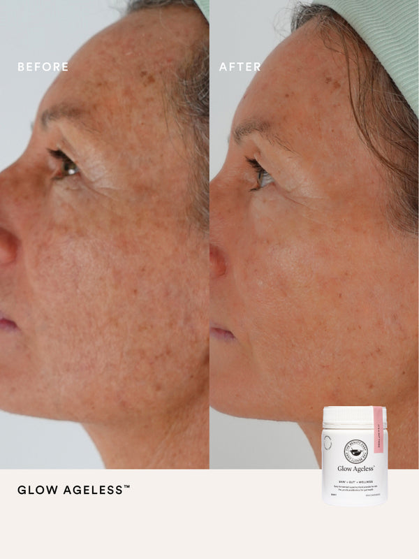 Second before and after comparison using The Beauty Chef Glow Ageless