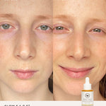 Before and after comparison using The Beauty Chef Glow FACE oil