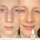 Before and after comparison using The Beauty Chef Glow FACE oil