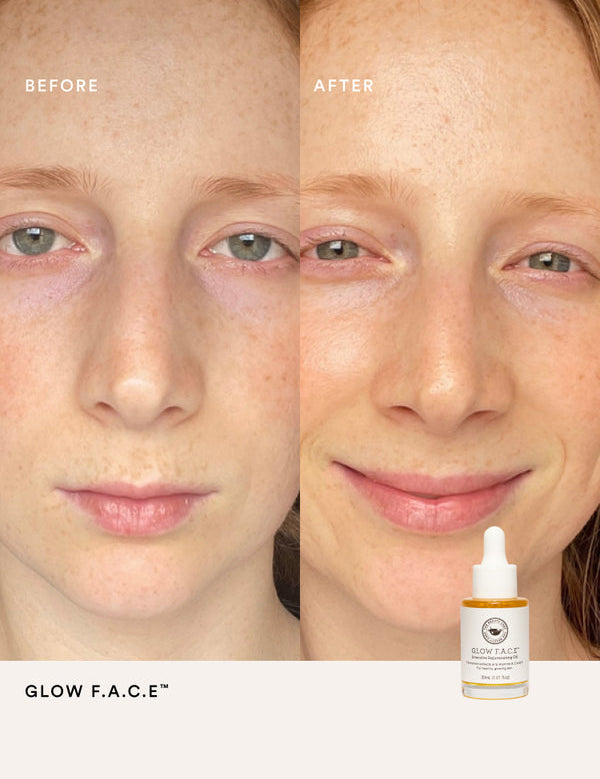 Before and after comparison using The Beauty Chef Glow FACE oil