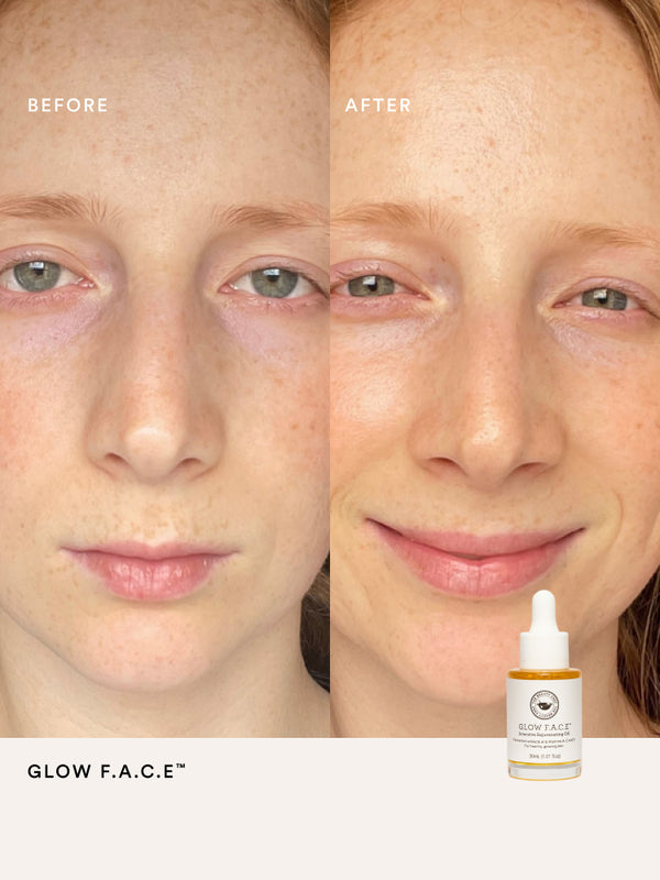 Before and after comparison using The Beauty Chef Glow FACE oil