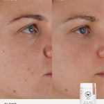 Before and after comparison using The Beauty Chef Glow