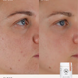 Before and after comparison using The Beauty Chef Glow