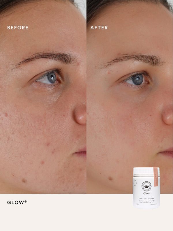 Before and after comparison using The Beauty Chef Glow