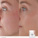 Second before and after comparison using The Beauty Chef Glow