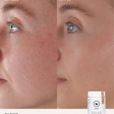 Second before and after comparison using The Beauty Chef Glow