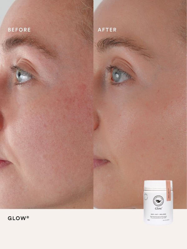Second before and after comparison using The Beauty Chef Glow