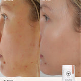 Third before and after comparison using The Beauty Chef Glow