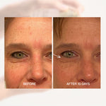 Before and after eye area comparison after ten days using The Jojoba Company Ultimate Serum