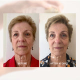 Before and after skin comparison using The Jojoba Company Ultimate Serum