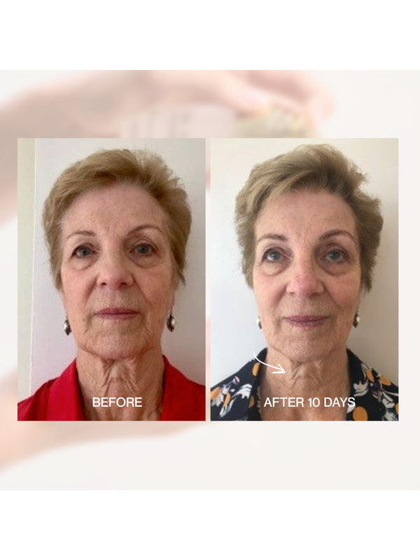 Before and after skin comparison using The Jojoba Company Ultimate Serum