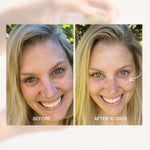 Before and after face comparison using The Jojoba Company Ultimate Serum