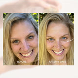 Before and after face comparison using The Jojoba Company Ultimate Serum