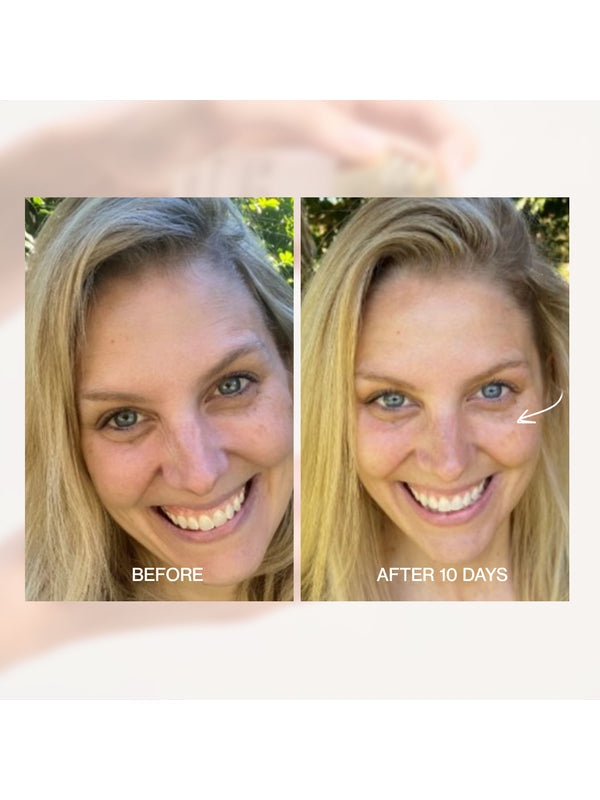 Before and after face comparison using The Jojoba Company Ultimate Serum