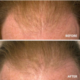 Before and after hair density result using A bit Hippy Hair Growth Serum