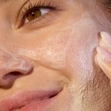 Close-up of ACURE Seriously Soothing Cleansing Cream applied to the face