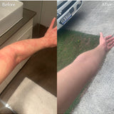 Before and after skin results using Calm Tallow Balm – Thrive Tallow Calm Tallow Balm 100ml