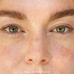 Before and after of a woman's under-eye area after using Ere Perez Grape Water Eye Serum