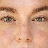 Before and after of a woman's under-eye area after using Ere Perez Grape Water Eye Serum