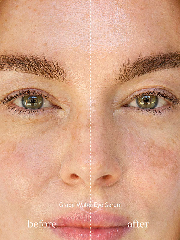 Before and after of a woman's under-eye area after using Ere Perez Grape Water Eye Serum