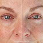 Before and after of a mature woman's eye area after using Ere Perez Grape Water Eye Serum