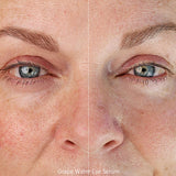Before and after of a mature woman's eye area after using Ere Perez Grape Water Eye Serum