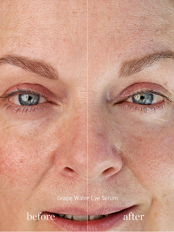 Before and after of a mature woman's eye area after using Ere Perez Grape Water Eye Serum