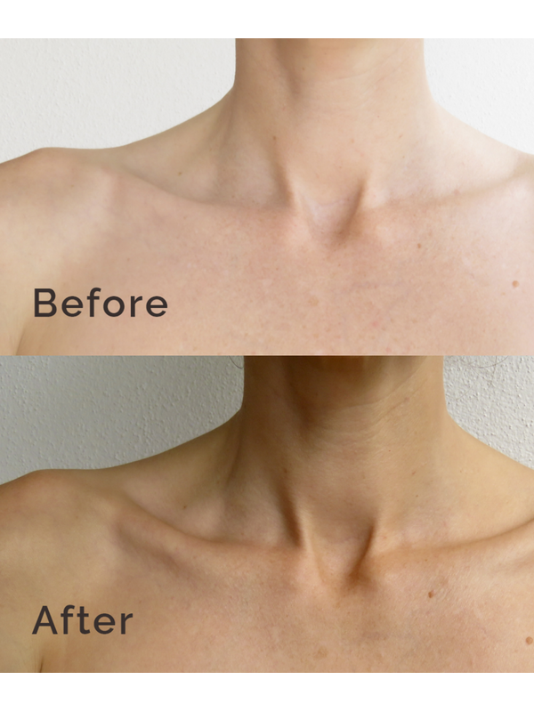 Before and after comparison using LAMAV Self Tanning Lotion