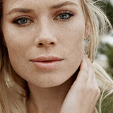Outdoor portrait of a blonde woman with visible freckles and naturally hydrated skin, resting one hand against her neck.