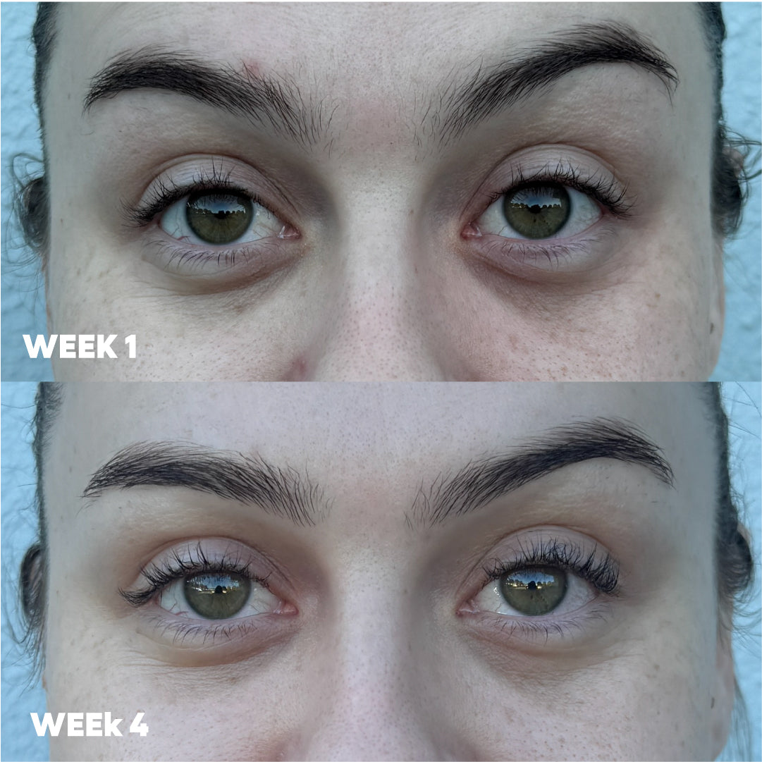 MooGoo 3-in-1 Peptide Eye Serum before and after results