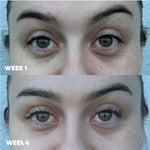 MooGoo 3-in-1 Peptide Eye Serum before and after results