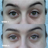 MooGoo 3-in-1 Peptide Eye Serum before and after results