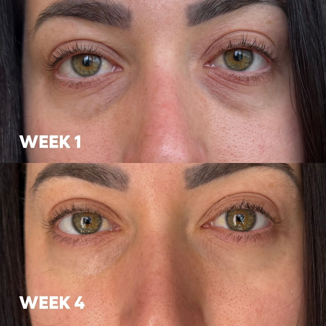 MooGoo 3-in-1 Peptide Eye Serum before and after results