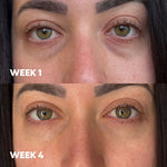 MooGoo 3-in-1 Peptide Eye Serum before and after results