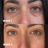 MooGoo 3-in-1 Peptide Eye Serum before and after results