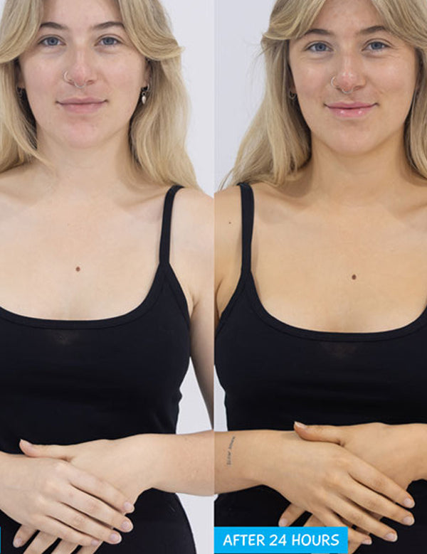 Side-by-side photos of a person with a blonde fringe wearing a black camisole, labelled Before and After 24 Hours, with a warmer tan in the second photo.