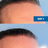 Two-panel MooGoo Hair Growth Serum comparison showing the hairline at Day 1 and visibly fuller-looking hair at Day 21.