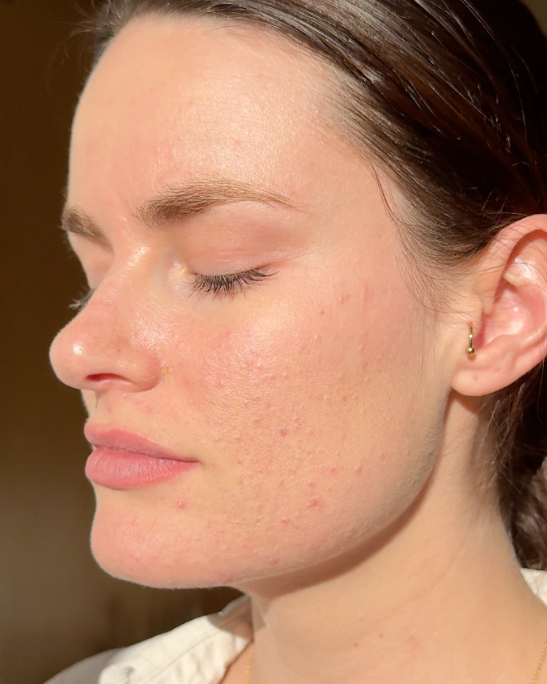 Woman's clear complexion after using Mukti Barrier Repair Serum