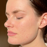 Woman's clear complexion after using Mukti Barrier Repair Serum